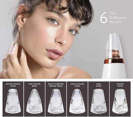 6 in 1 Multi-function Blackhead Remover Tools – Facial Pore Cleaner Kit for Deep Cleansing, Acne & Blackhead Removal